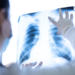 health screening, NHS, employee benefits, wellbeing, preventative, health checks